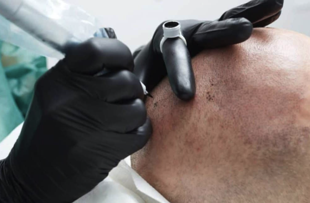 Corso di tricopigmentazione cosa impari e come diventare un esperto